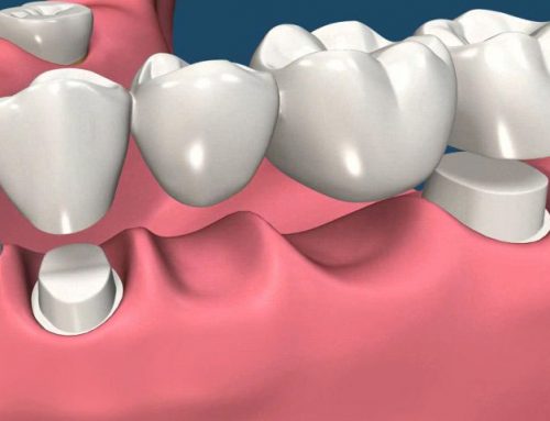 Why the deficiencies of both the anterior and posterior teeth should be restored