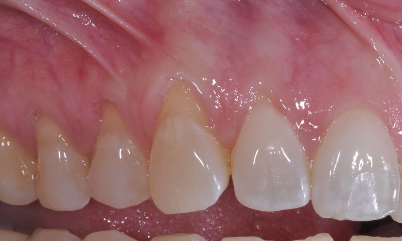 ufi1